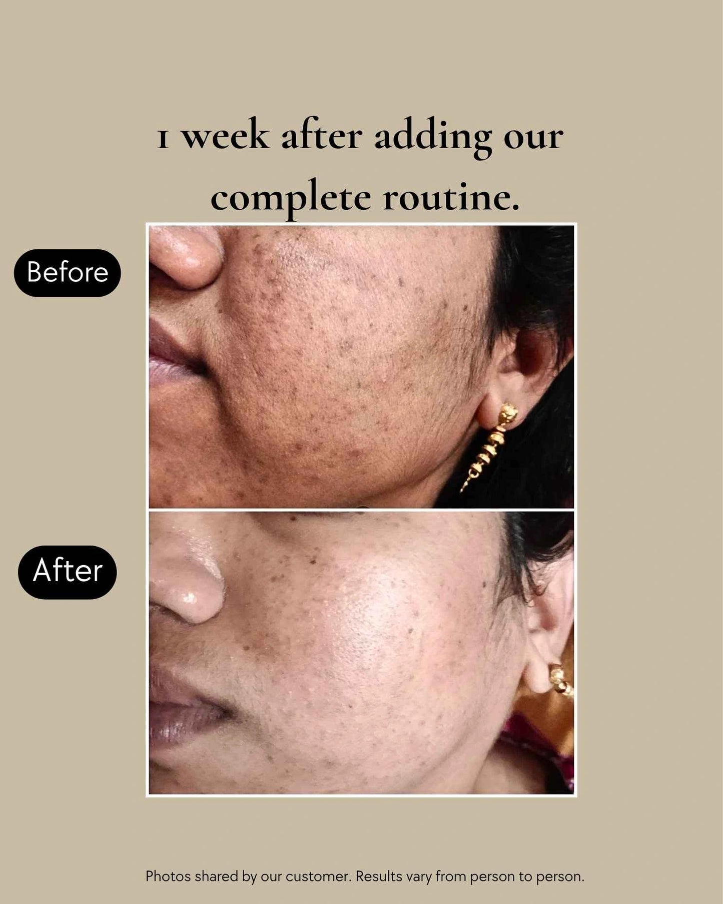 Clear Complexion Transformation System