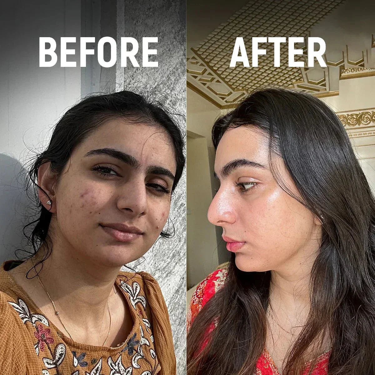 I Lost My Glow to Makeup - skshafeen
