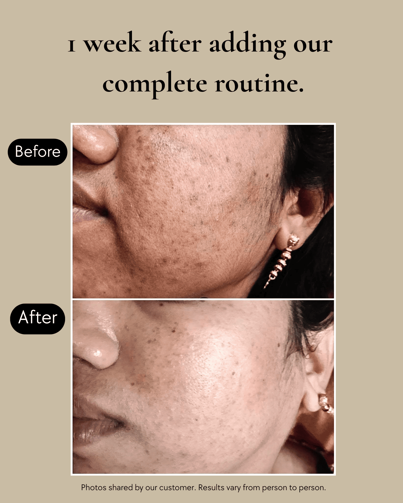 Clear Complexion Transformation System