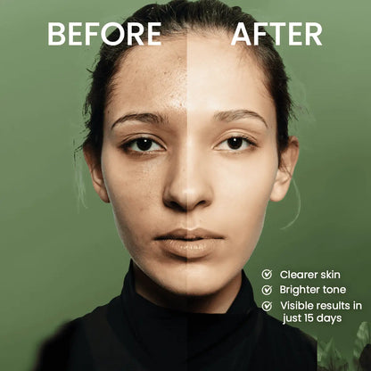 Clear Complexion 15-Days Challenge -Real, Visible Skin Transformation