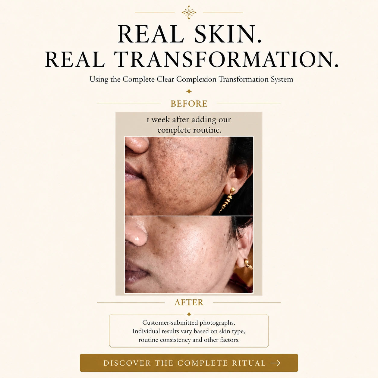 Clear Complexion Transformation System