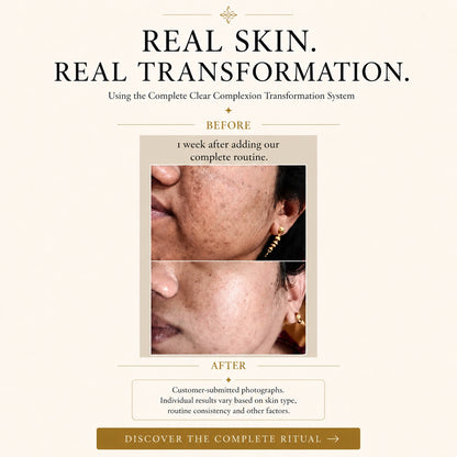 Clear Complexion Transformation System