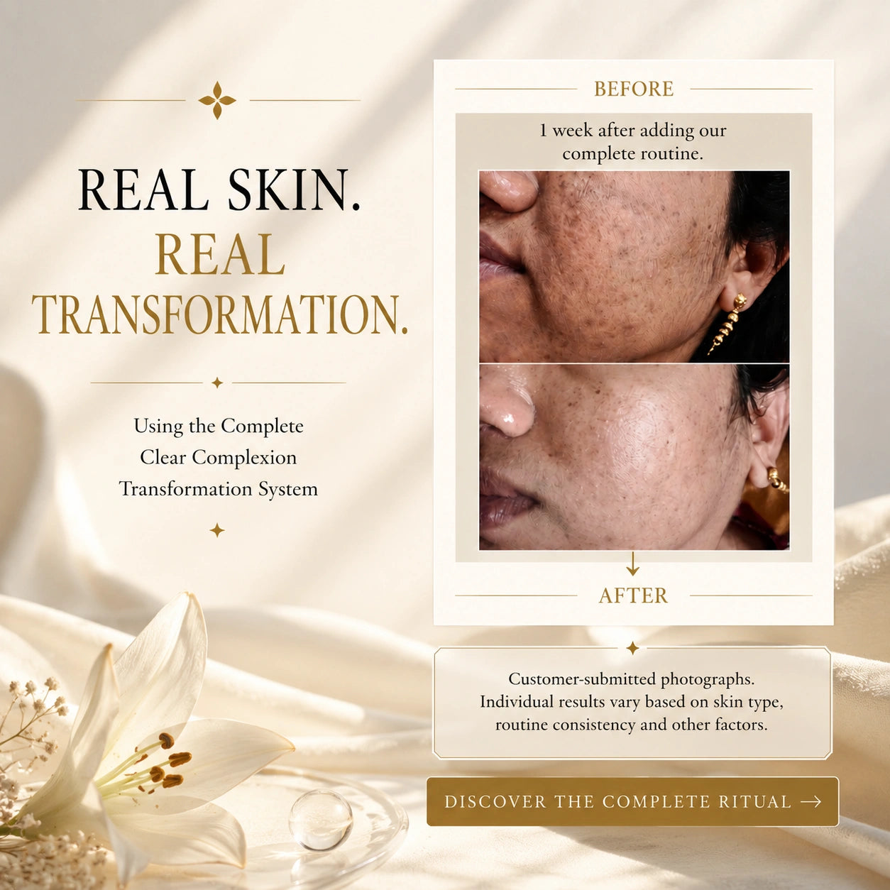 Clear Complexion Transformation System