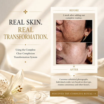 Clear Complexion Transformation System
