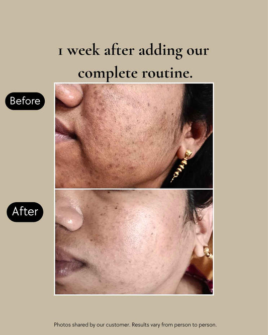 Clear Complexion Transformation System