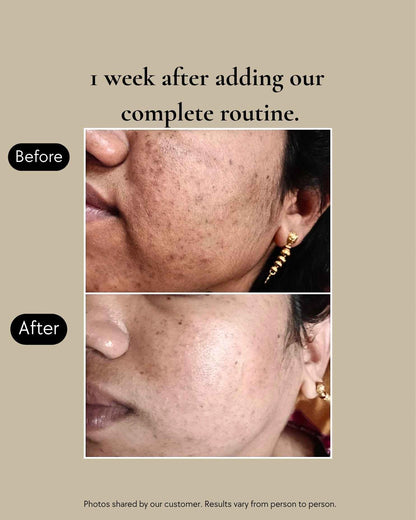 Clear Complexion Transformation System