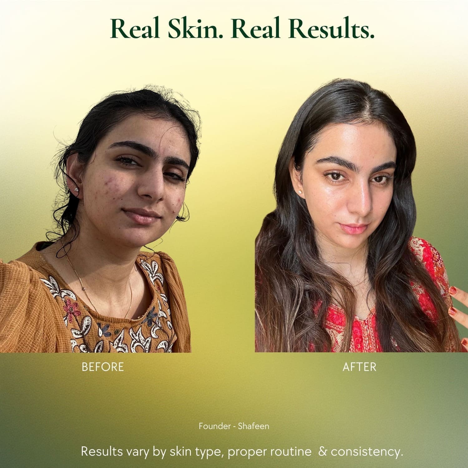 Clear Complexion Skin Softener Serum - 50+ herbs infused - skshafeen - skshafeen